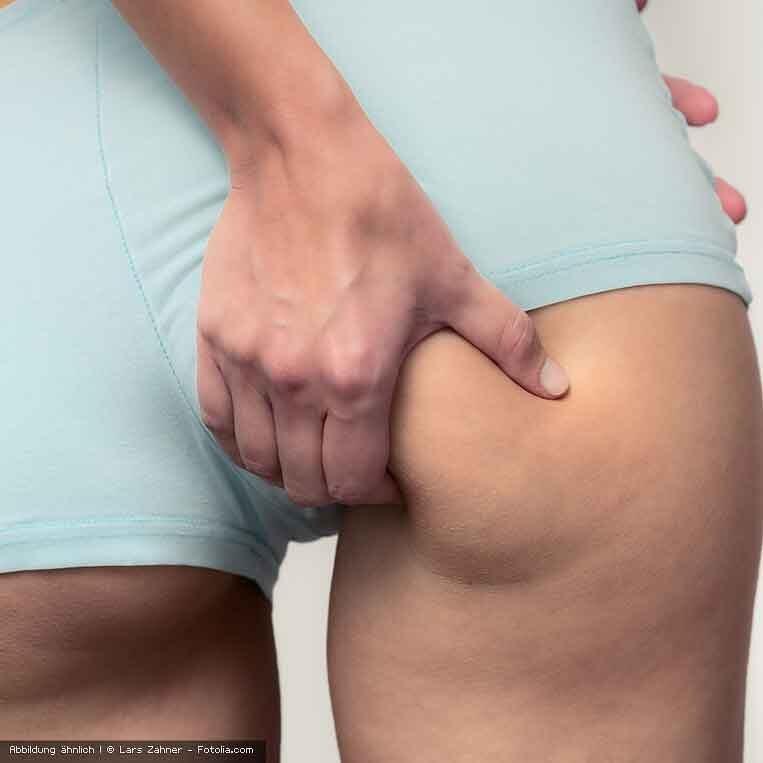 basisches Cellulite-Gel wirkt straffend basisches Cellulite-Gel wirkt straffend